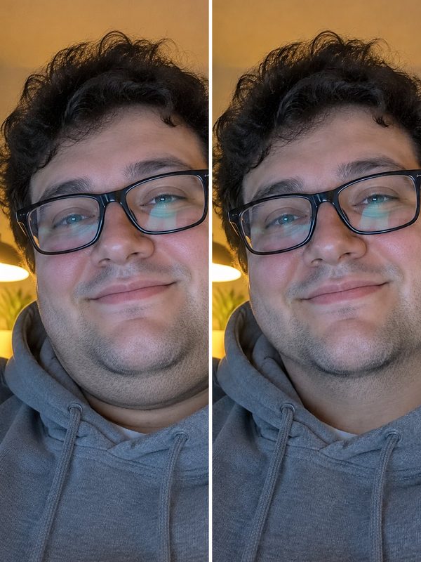 Double Chin Remover